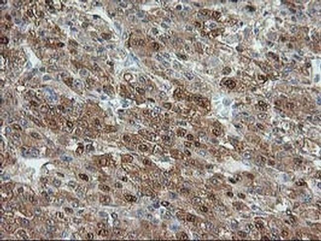 Aminoacylase Antibody in Immunohistochemistry (Paraffin) (IHC (P))