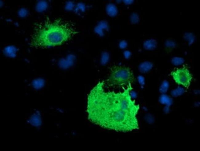 PDE1B Antibody in Immunocytochemistry (ICC/IF)