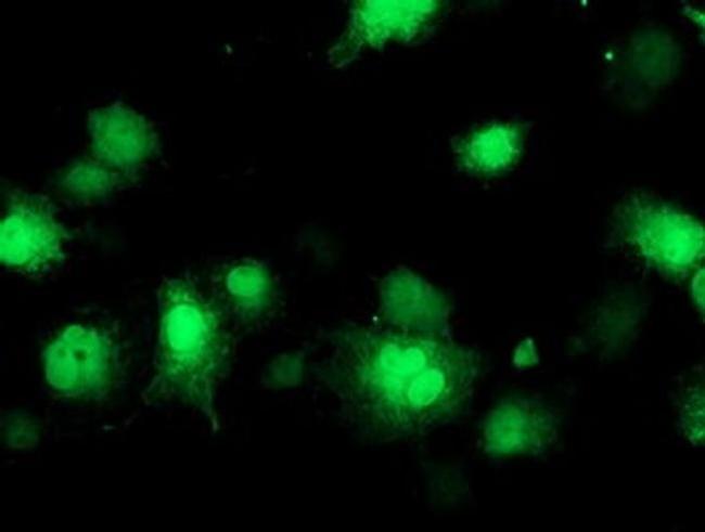 CoA Synthase Antibody in Immunocytochemistry (ICC/IF)