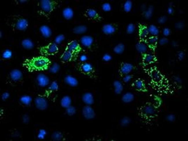 DLD Antibody in Immunocytochemistry (ICC/IF)