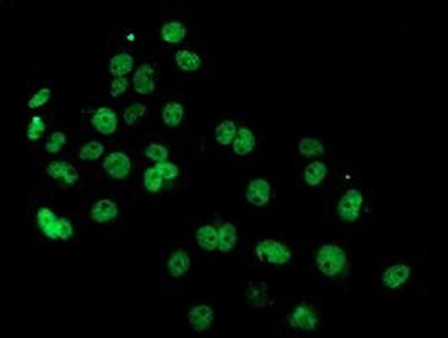 PDE4B Antibody in Immunocytochemistry (ICC/IF)