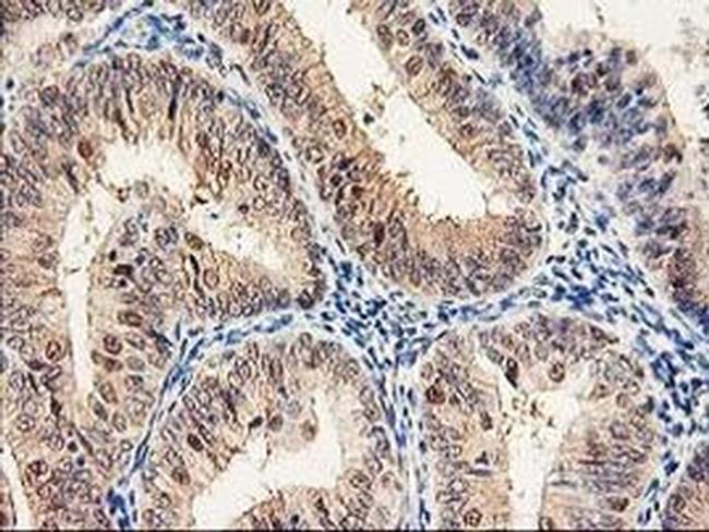 PSMB4 Antibody in Immunohistochemistry (Paraffin) (IHC (P))