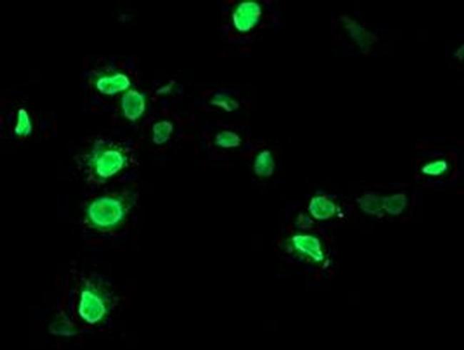 UNG Antibody in Immunocytochemistry (ICC/IF)