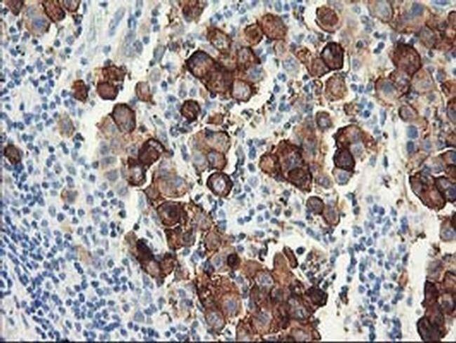 DPP10 Antibody in Immunohistochemistry (Paraffin) (IHC (P))