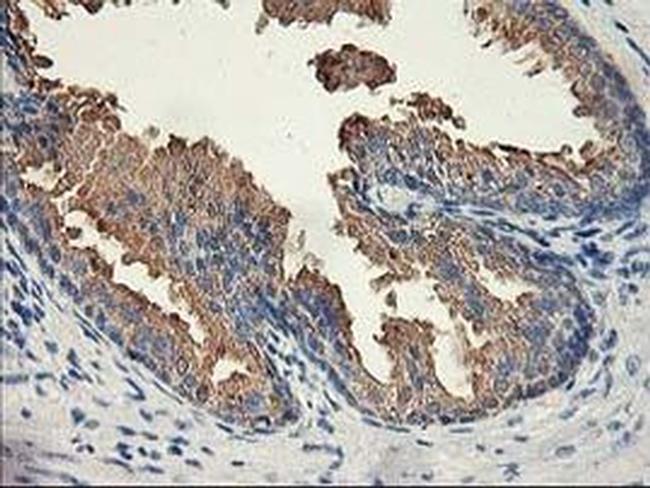 ACSS2 Antibody in Immunohistochemistry (Paraffin) (IHC (P))