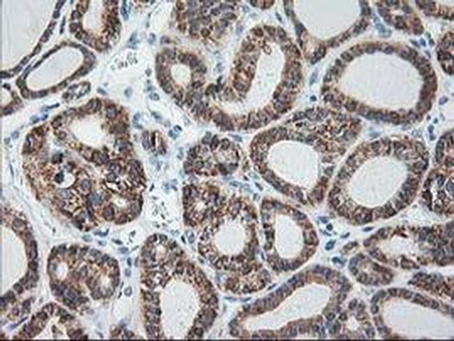 Ribophorin I Antibody in Immunohistochemistry (Paraffin) (IHC (P))