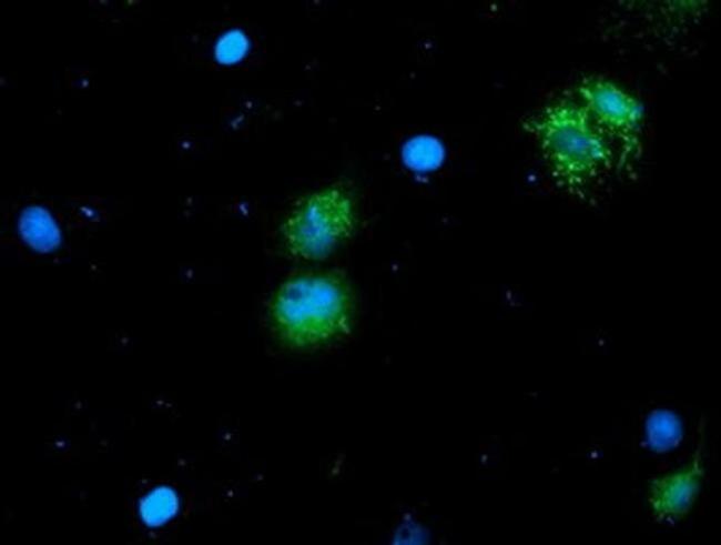 ALS2CR1 Antibody in Immunocytochemistry (ICC/IF)