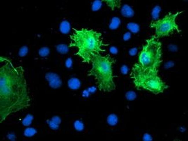 Calponin 2 Antibody in Immunocytochemistry (ICC/IF)