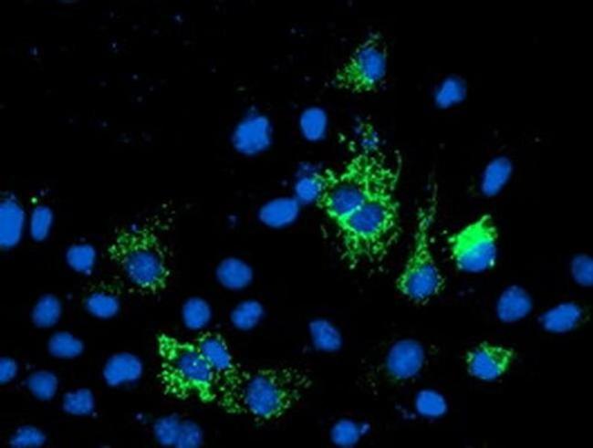 ALS2CR1 Antibody in Immunocytochemistry (ICC/IF)