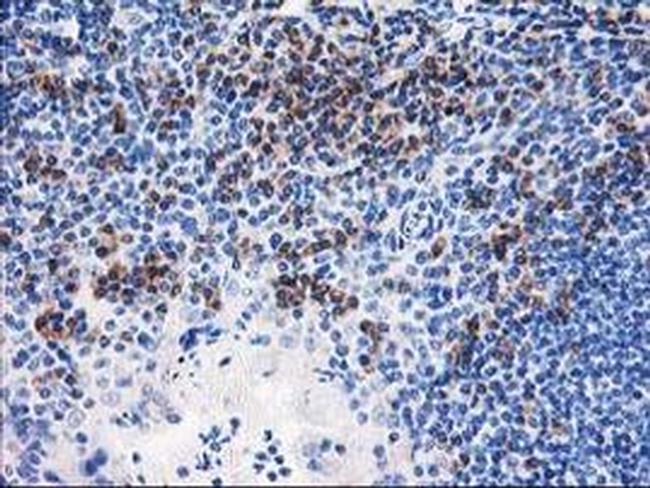 NUBPL Antibody in Immunohistochemistry (Paraffin) (IHC (P))