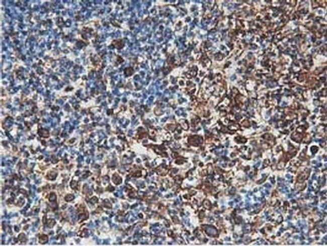 Latexin Antibody in Immunohistochemistry (Paraffin) (IHC (P))