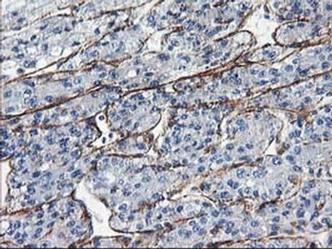 LDLRAP1 Antibody in Immunohistochemistry (Paraffin) (IHC (P))