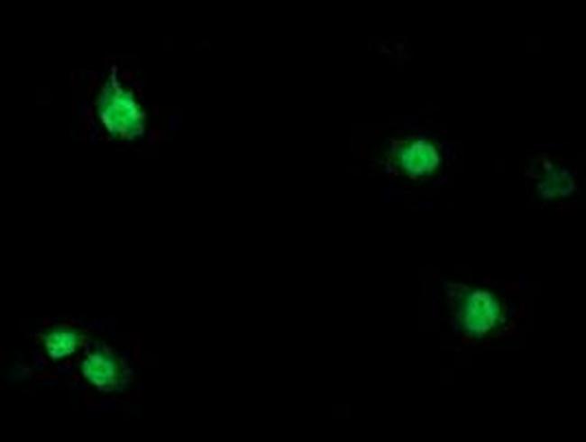 SDS Antibody in Immunocytochemistry (ICC/IF)