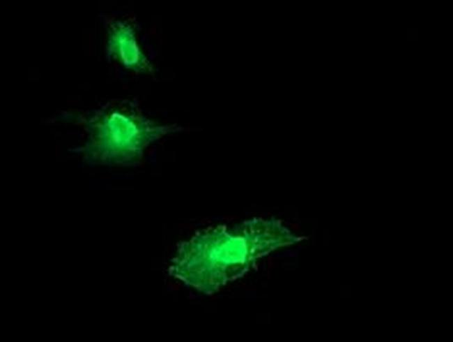 RGS16 Antibody in Immunocytochemistry (ICC/IF)