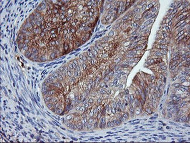 CD249 Antibody in Immunohistochemistry (Paraffin) (IHC (P))