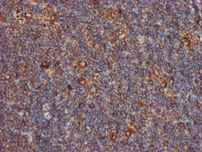 ERP72 Antibody in Immunohistochemistry (Paraffin) (IHC (P))