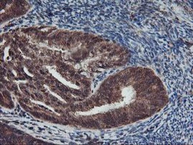 AGPAT5 Antibody in Immunohistochemistry (Paraffin) (IHC (P))