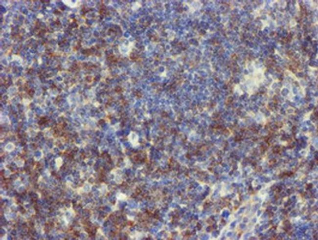 NMT2 Antibody in Immunohistochemistry (Paraffin) (IHC (P))