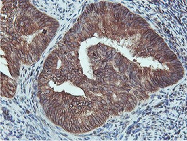 C20orf3 Antibody in Immunohistochemistry (Paraffin) (IHC (P))