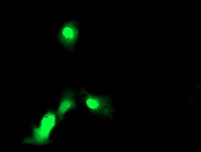 EXOSC7 Antibody in Immunocytochemistry (ICC/IF)