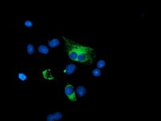 GADD34 Antibody in Immunocytochemistry (ICC/IF)