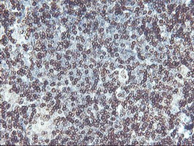 C20orf3 Antibody in Immunohistochemistry (Paraffin) (IHC (P))