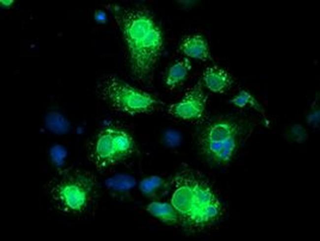 Neuroplastin Antibody in Immunocytochemistry (ICC/IF)