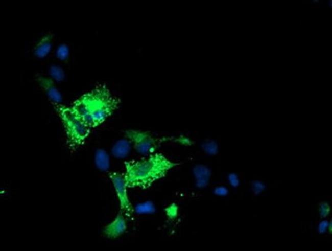 ALOX15 Antibody in Immunocytochemistry (ICC/IF)