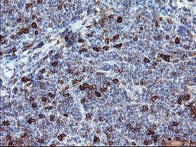 BCAT1 Antibody in Immunohistochemistry (Paraffin) (IHC (P))