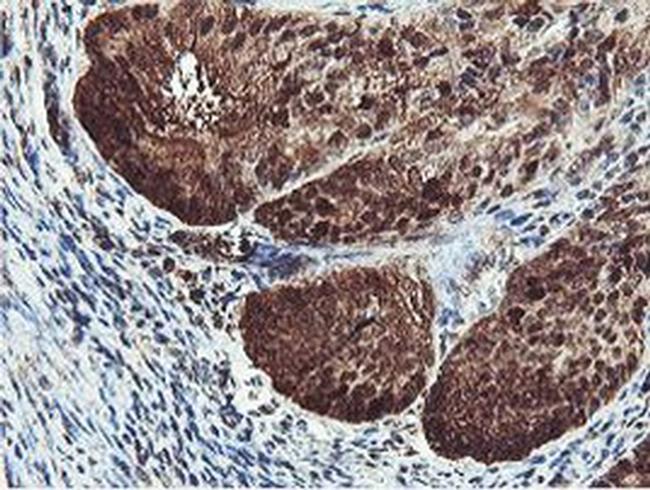 PSMB7 Antibody in Immunohistochemistry (Paraffin) (IHC (P))