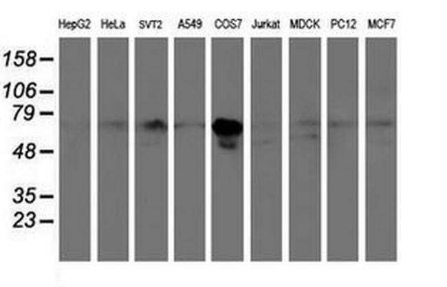 PPAT Antibody in Western Blot (WB)