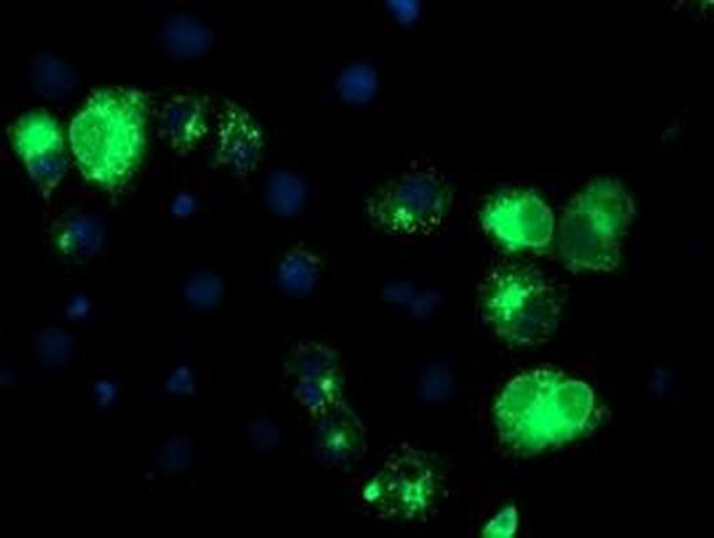 TFR2 Antibody in Immunocytochemistry (ICC/IF)