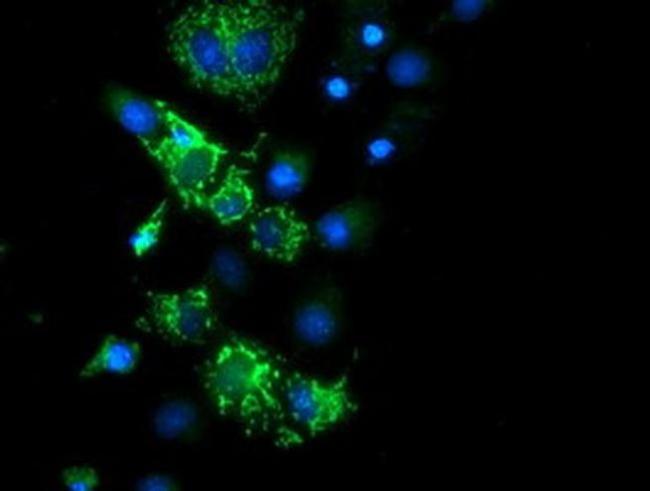 CYB5R1 Antibody in Immunocytochemistry (ICC/IF)