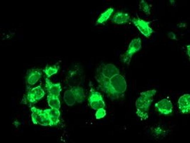 TFR2 Antibody in Immunocytochemistry (ICC/IF)