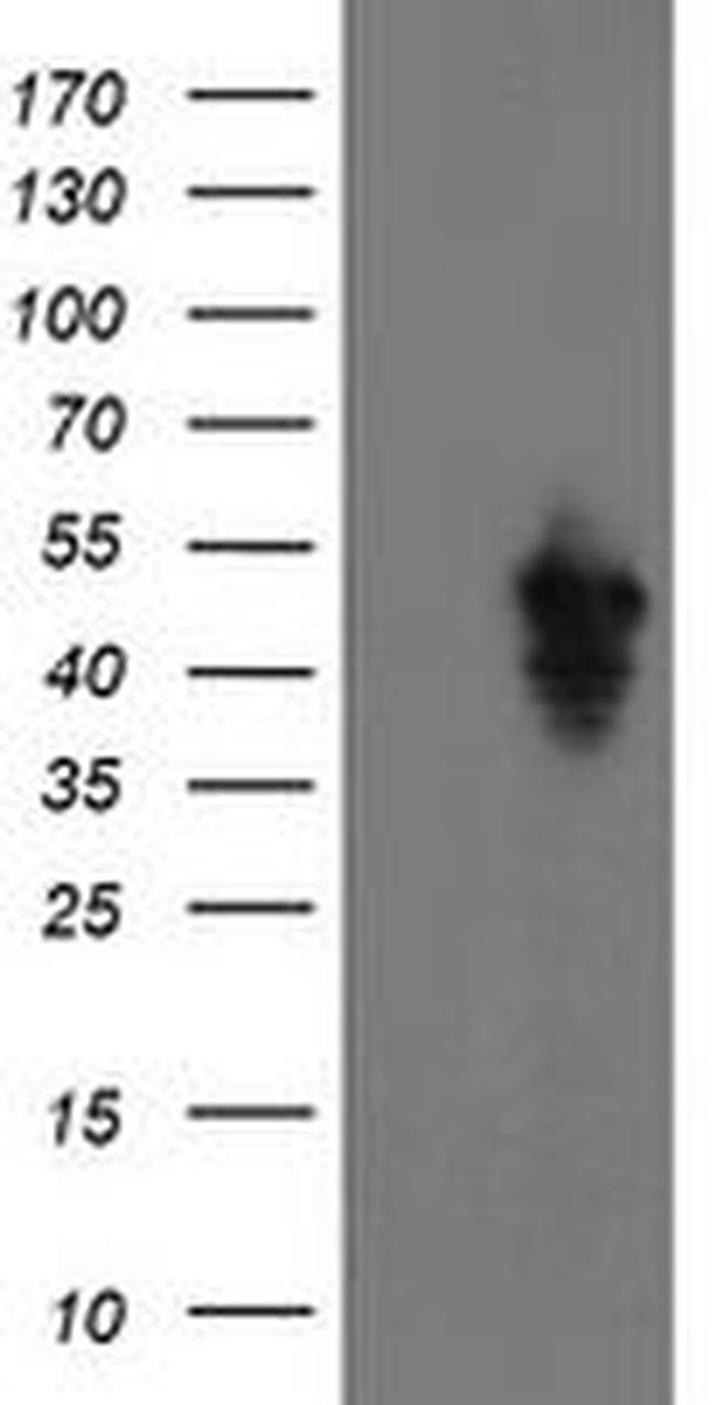 SERPINE2 Antibody in Western Blot (WB)