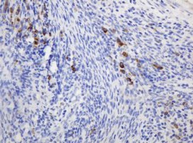 Ribophorin II Antibody in Immunohistochemistry (Paraffin) (IHC (P))