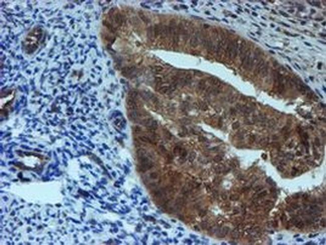 SAT2 Antibody in Immunohistochemistry (Paraffin) (IHC (P))