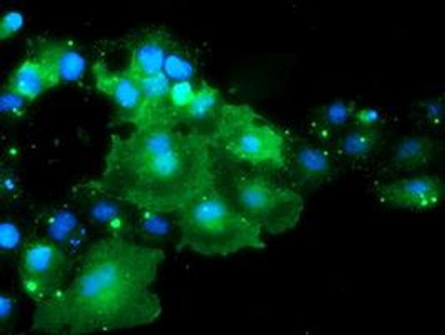 DOK7 Antibody in Immunocytochemistry (ICC/IF)