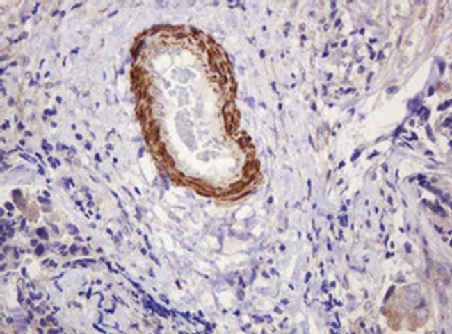 PADI4 Antibody in Immunohistochemistry (Paraffin) (IHC (P))