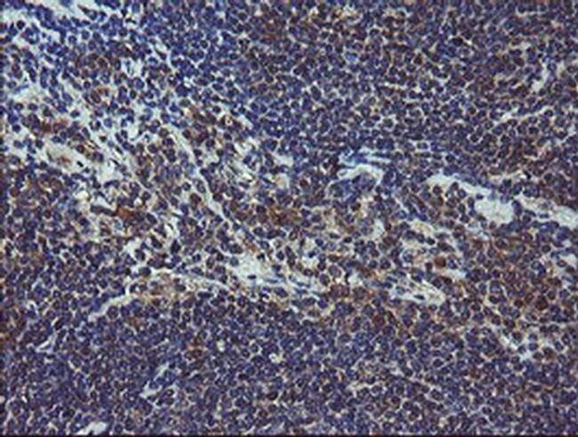 COMMD1 Antibody in Immunohistochemistry (Paraffin) (IHC (P))