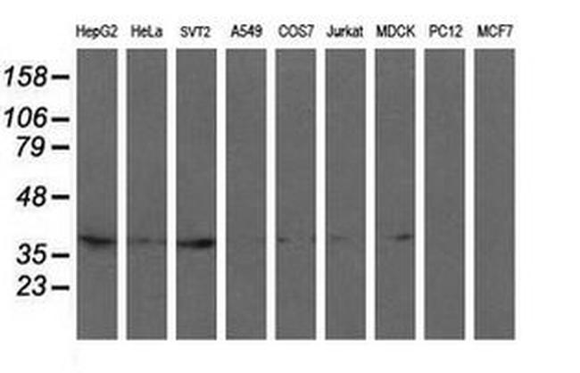 RFC2 Antibody in Western Blot (WB)