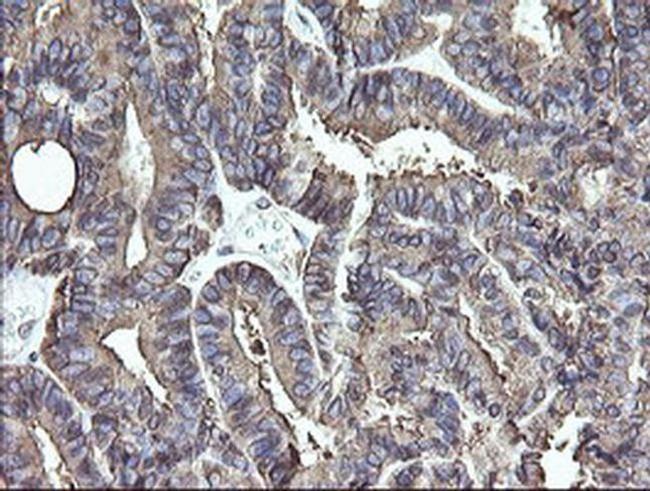 ERp57 Antibody in Immunohistochemistry (Paraffin) (IHC (P))