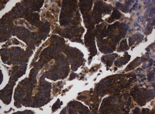 ASGR2 Antibody in Immunohistochemistry (Paraffin) (IHC (P))