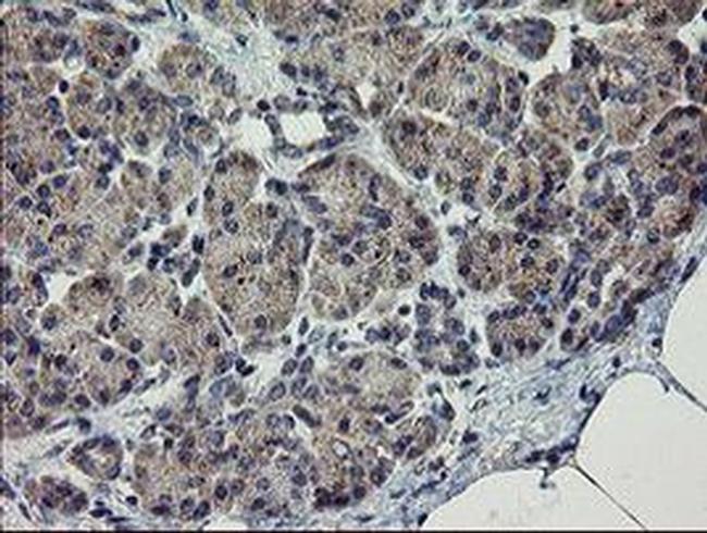 CHN1 Antibody in Immunohistochemistry (Paraffin) (IHC (P))