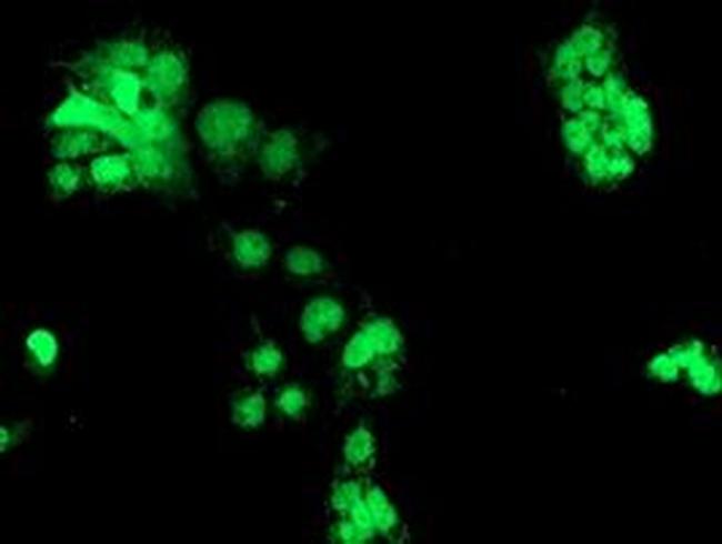 CHN1 Antibody in Immunocytochemistry (ICC/IF)