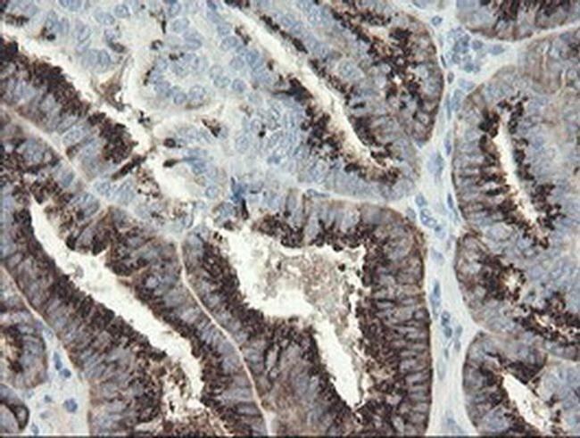 SLA2 Antibody in Immunohistochemistry (Paraffin) (IHC (P))