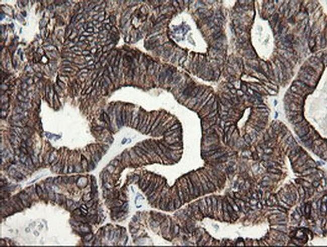 SLA2 Antibody in Immunohistochemistry (Paraffin) (IHC (P))