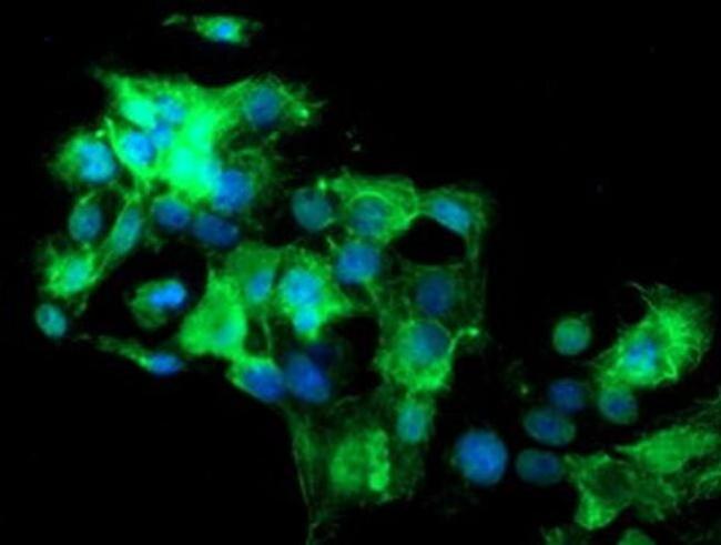 SLA2 Antibody in Immunocytochemistry (ICC/IF)