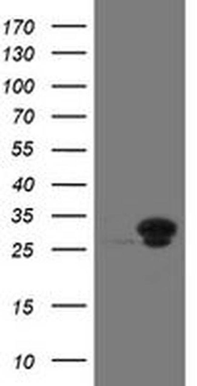 UBE2S Antibody in Western Blot (WB)