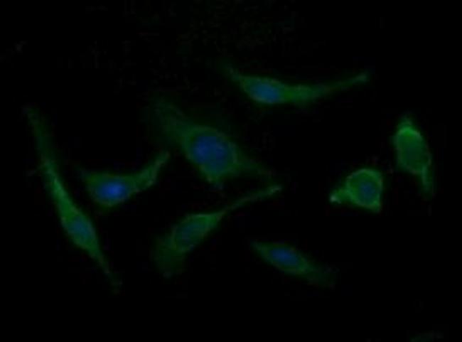 B3GNT2 Antibody in Immunocytochemistry (ICC/IF)